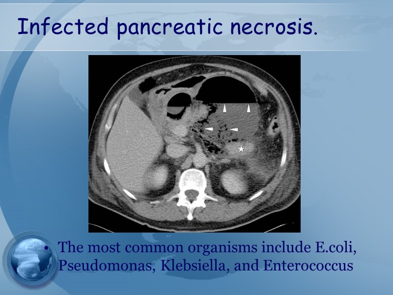 Infected pancreatic necrosis.          The most